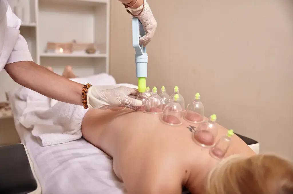 cupping therapy in Mumbai